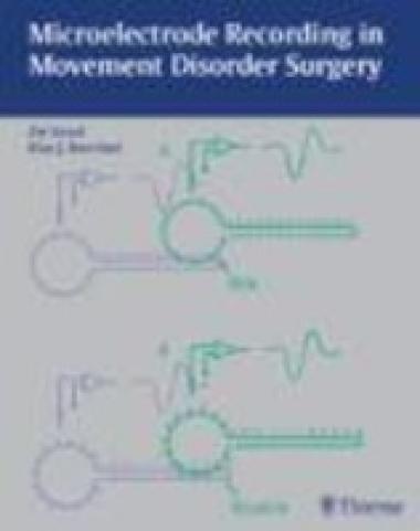 MICROELECTRODE RECORDING IN MOVEMENT DISORDER SURGERY