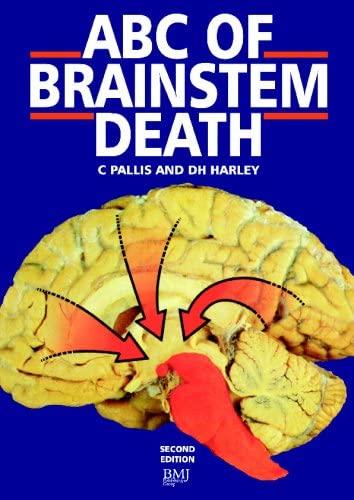 ABC of Brain Stem Death