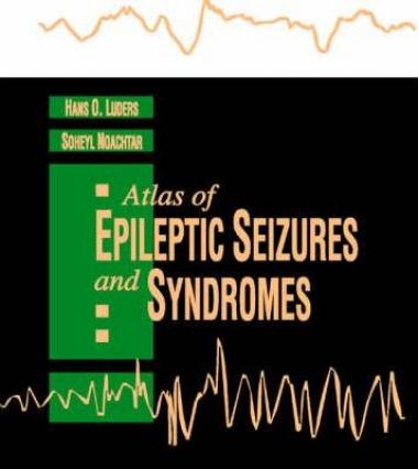 Atlas of Epileptic Seizures and Syndromes