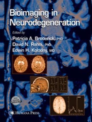 Bioimaging in Neurodegeneration