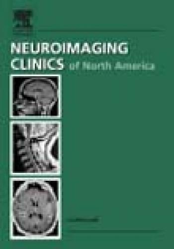 Alzheimer's Disease, An Issue of Neuroimaging Clinics