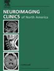 Alzheimer's Disease, An Issue of Neuroimaging Clinics